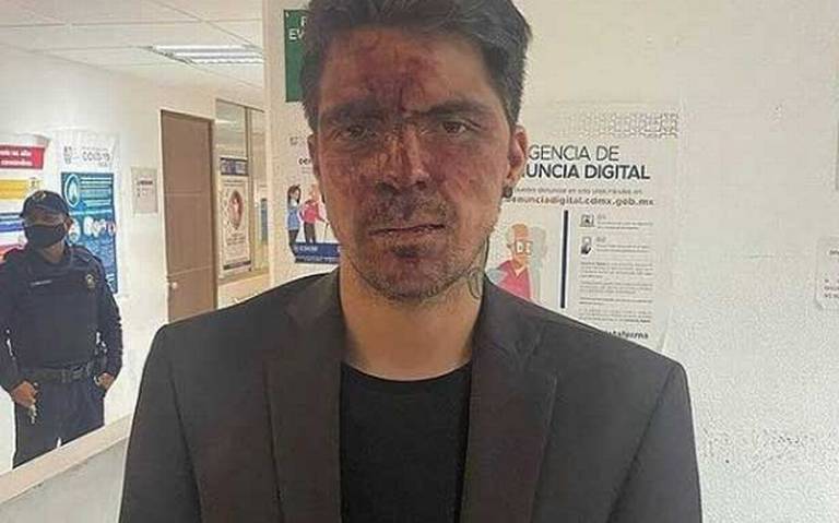 César D'Alessio, impedido para declarar